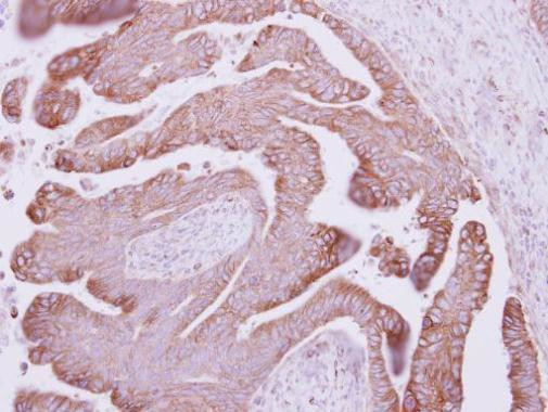 Catenin alpha-1 Antibody in Immunohistochemistry (Paraffin) (IHC (P))