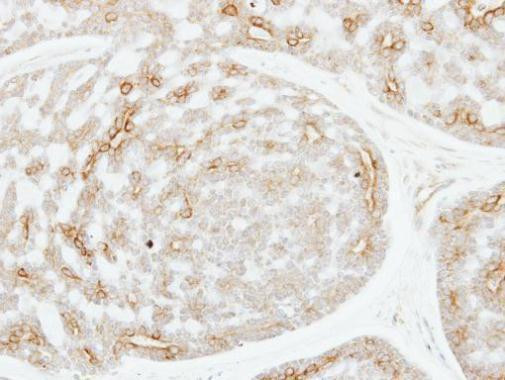 ADPGK Antibody in Immunohistochemistry (Paraffin) (IHC (P))