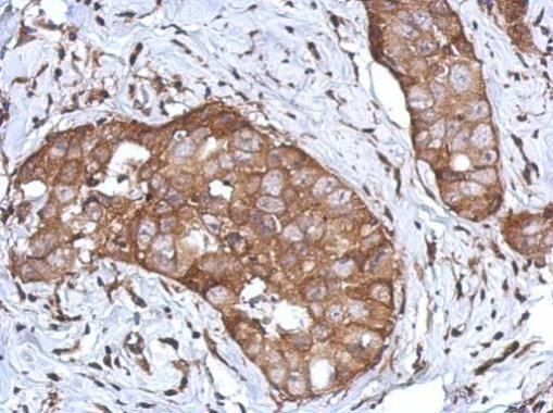 CD97 Antibody in Immunohistochemistry (Paraffin) (IHC (P))