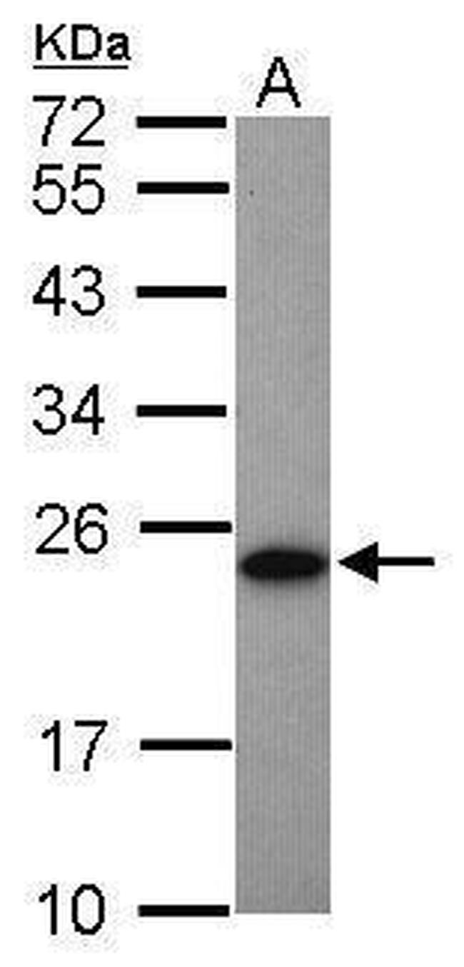 Adenylate Kinase 1 Antibody in Western Blot (WB)