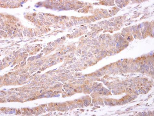 PTP1B Antibody in Immunohistochemistry (Paraffin) (IHC (P))