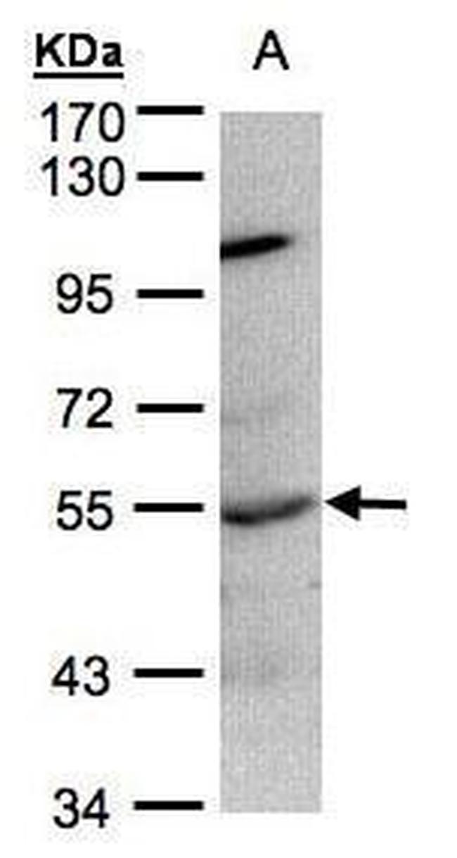 PTP1B Antibody in Western Blot (WB)