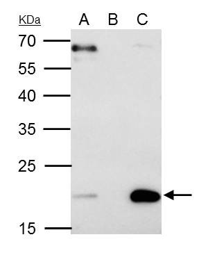 Sorcin Antibody in Immunoprecipitation (IP)