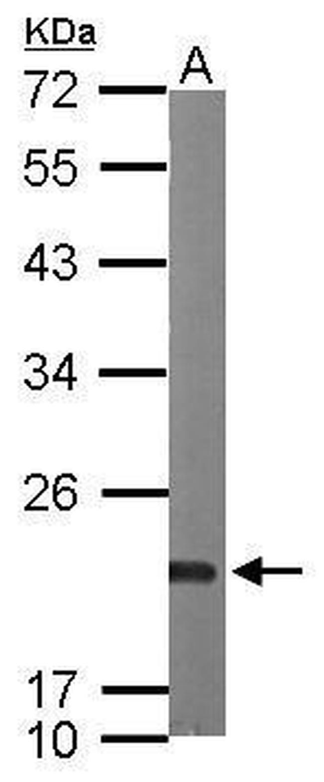 Sorcin Antibody in Western Blot (WB)