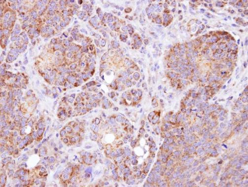 GSTZ1 Antibody in Immunohistochemistry (Paraffin) (IHC (P))