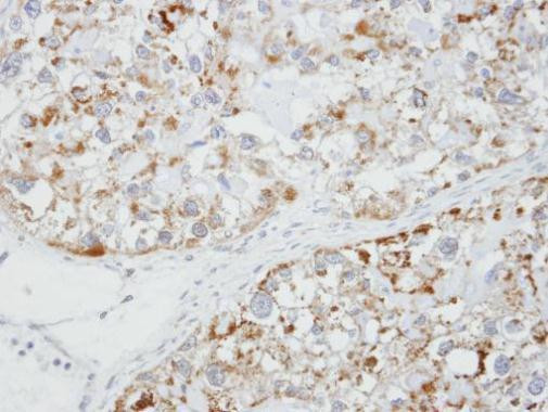 GLRA1 Antibody in Immunohistochemistry (Paraffin) (IHC (P))