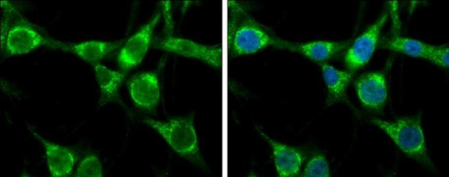 HSPA1B Antibody in Immunocytochemistry (ICC/IF)