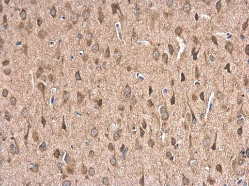 HSPA1B Antibody in Immunohistochemistry (Paraffin) (IHC (P))