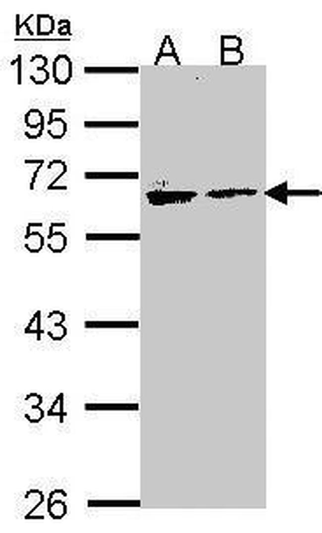 Arylsulfatase A Antibody in Western Blot (WB)