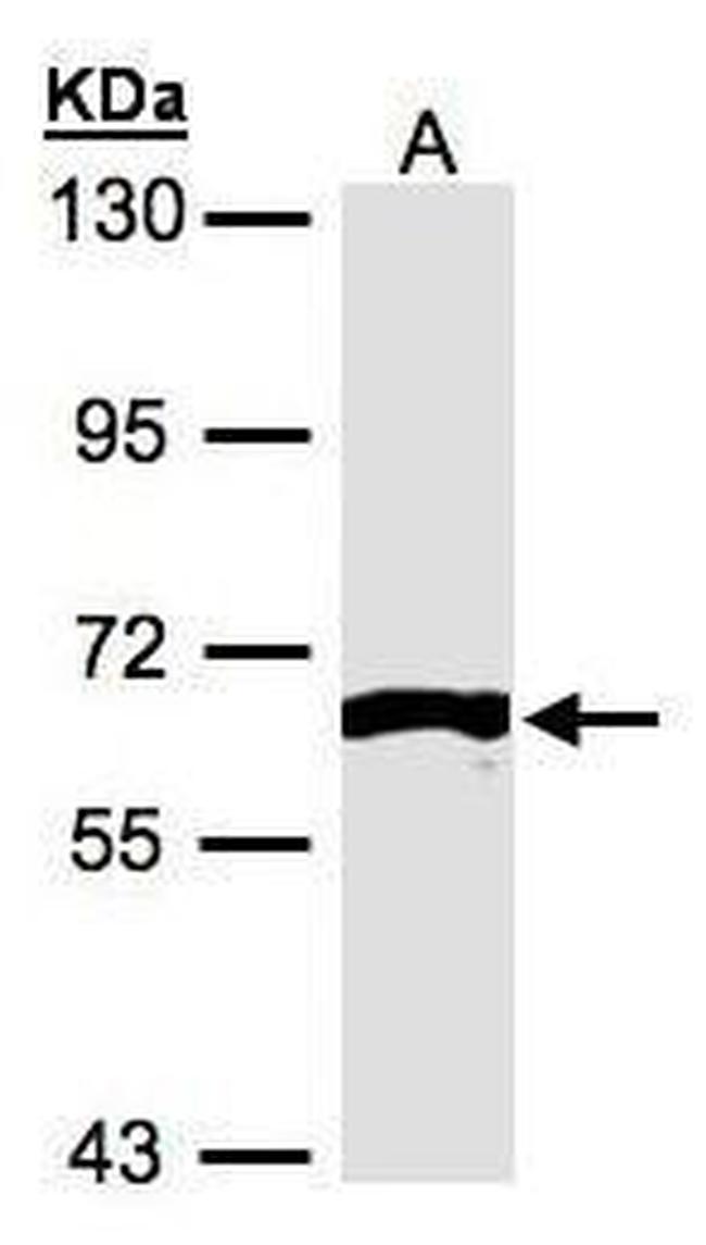 FRK Antibody in Western Blot (WB)