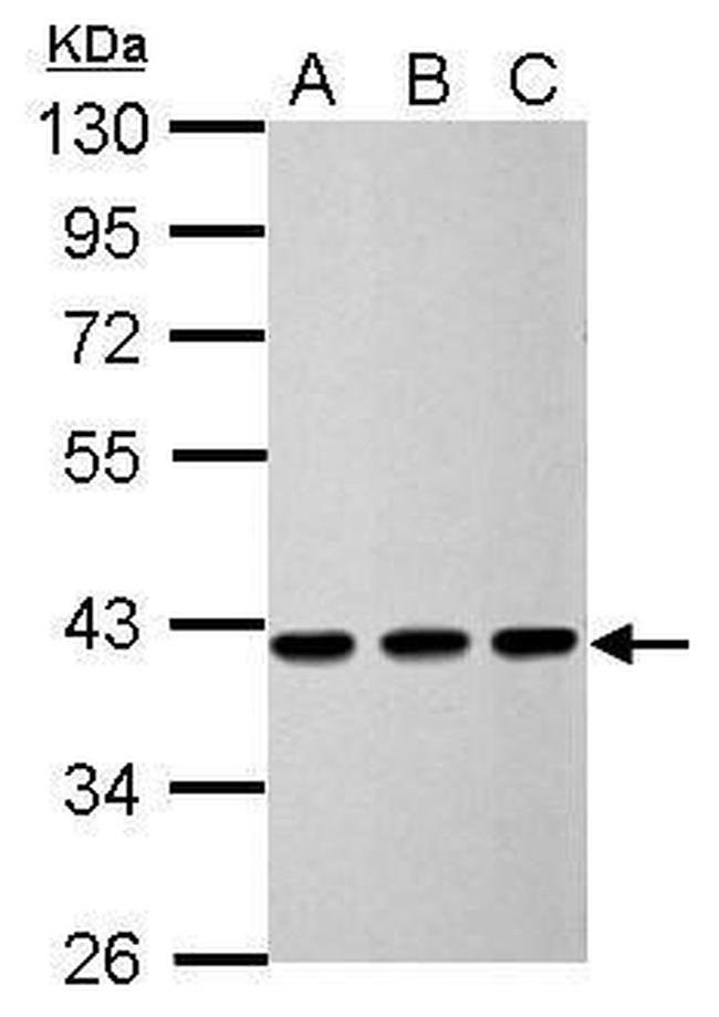 Calponin 3 Antibody in Western Blot (WB)