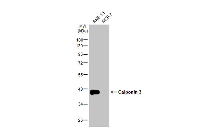 Calponin 3 Antibody in Western Blot (WB)