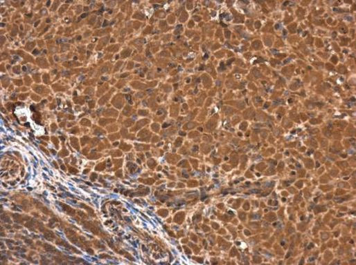 Calponin 3 Antibody in Immunohistochemistry (Paraffin) (IHC (P))