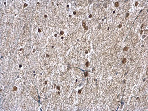 hnRNP A1 Antibody in Immunohistochemistry (Paraffin) (IHC (P))