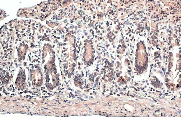 ESRRA Antibody in Immunohistochemistry (Paraffin) (IHC (P))