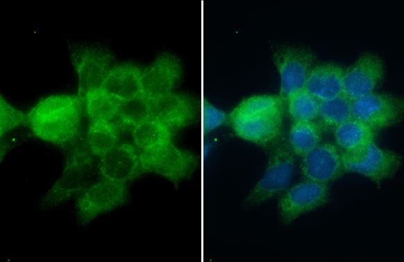 CD2AP Antibody in Immunocytochemistry (ICC/IF)