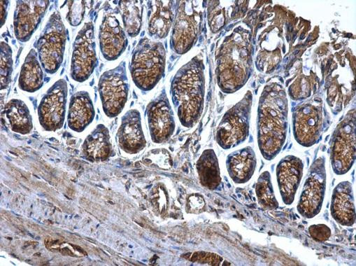 CD2AP Antibody in Immunohistochemistry (Paraffin) (IHC (P))