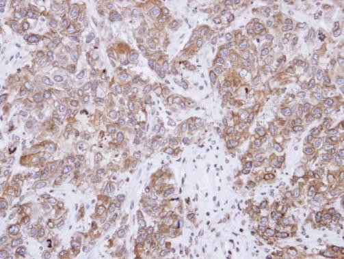 CD2AP Antibody in Immunohistochemistry (Paraffin) (IHC (P))