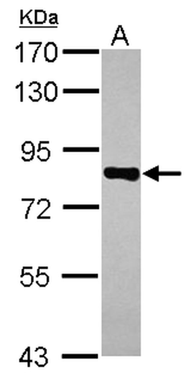 CD2AP Antibody in Western Blot (WB)