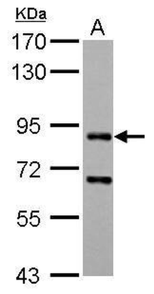 CD2AP Antibody in Western Blot (WB)