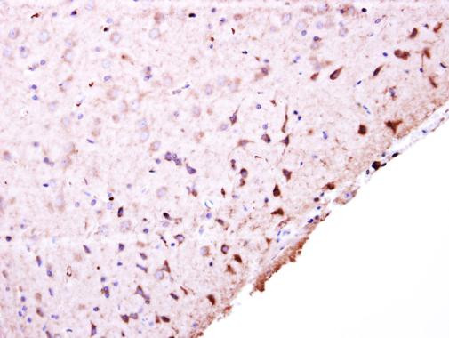 PFKFB4 Antibody in Immunohistochemistry (Paraffin) (IHC (P))