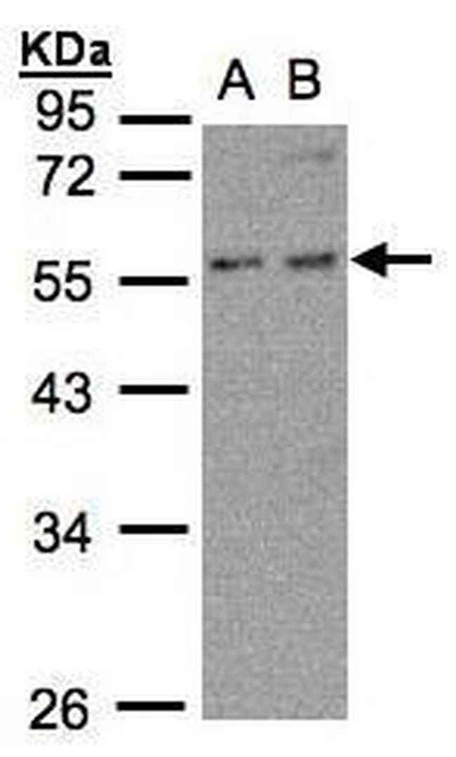 PFKFB4 Antibody in Western Blot (WB)