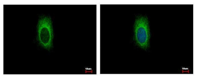 ZDHHC13 Antibody in Immunocytochemistry (ICC/IF)