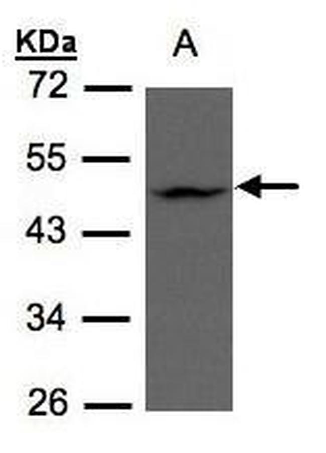 ZDHHC13 Antibody in Western Blot (WB)