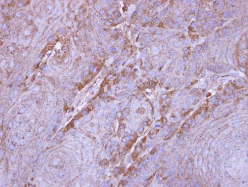 SIRT3 Antibody in Immunohistochemistry (Paraffin) (IHC (P))