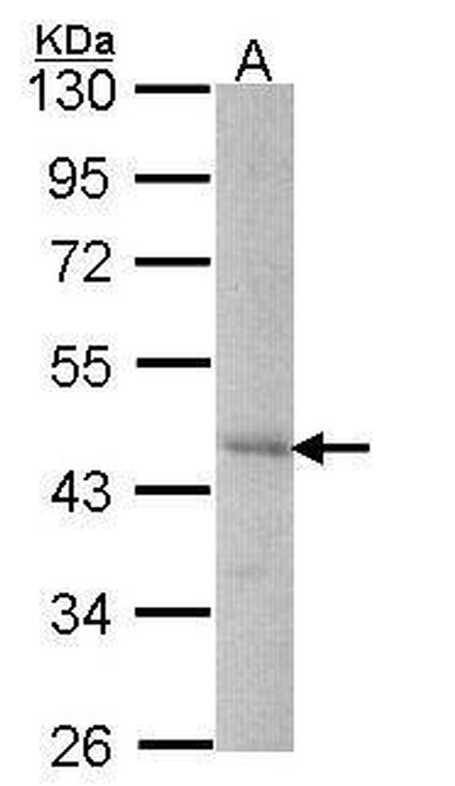 DYX1C1 Antibody in Western Blot (WB)