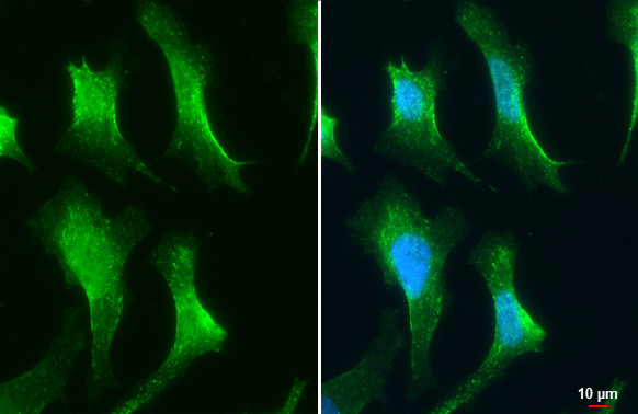 VPS26A Antibody in Immunocytochemistry (ICC/IF)