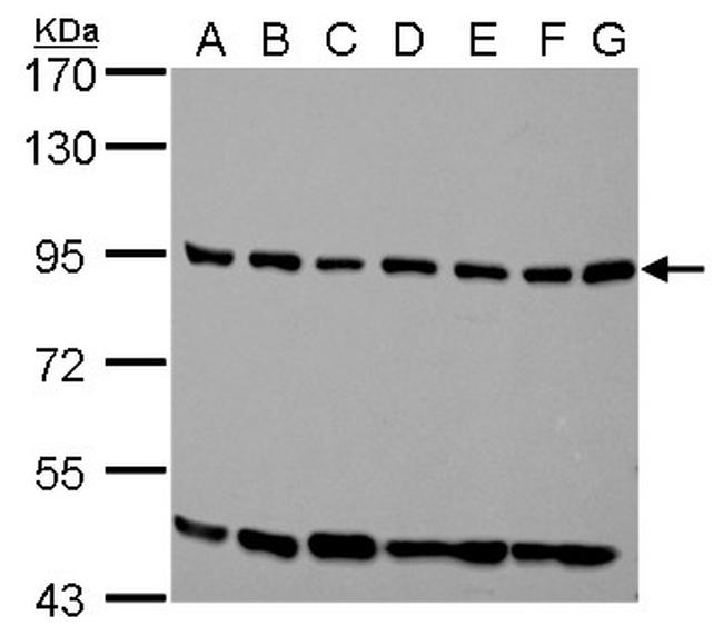 ELMO1 Antibody in Western Blot (WB)