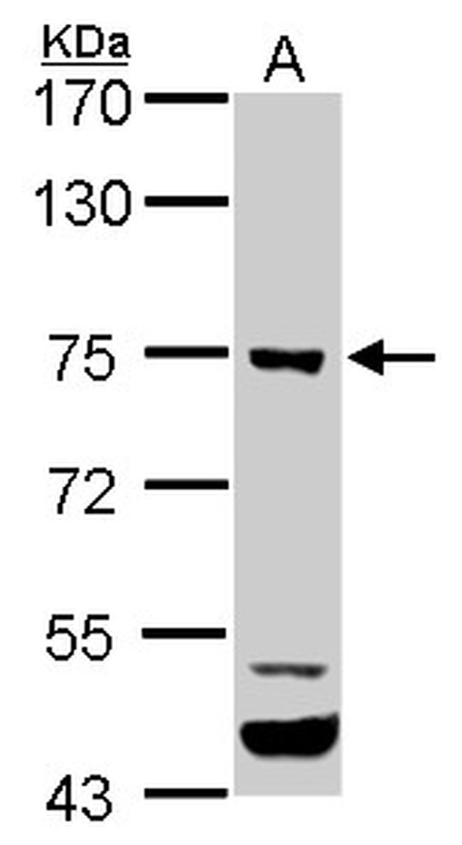 ELMO1 Antibody in Western Blot (WB)