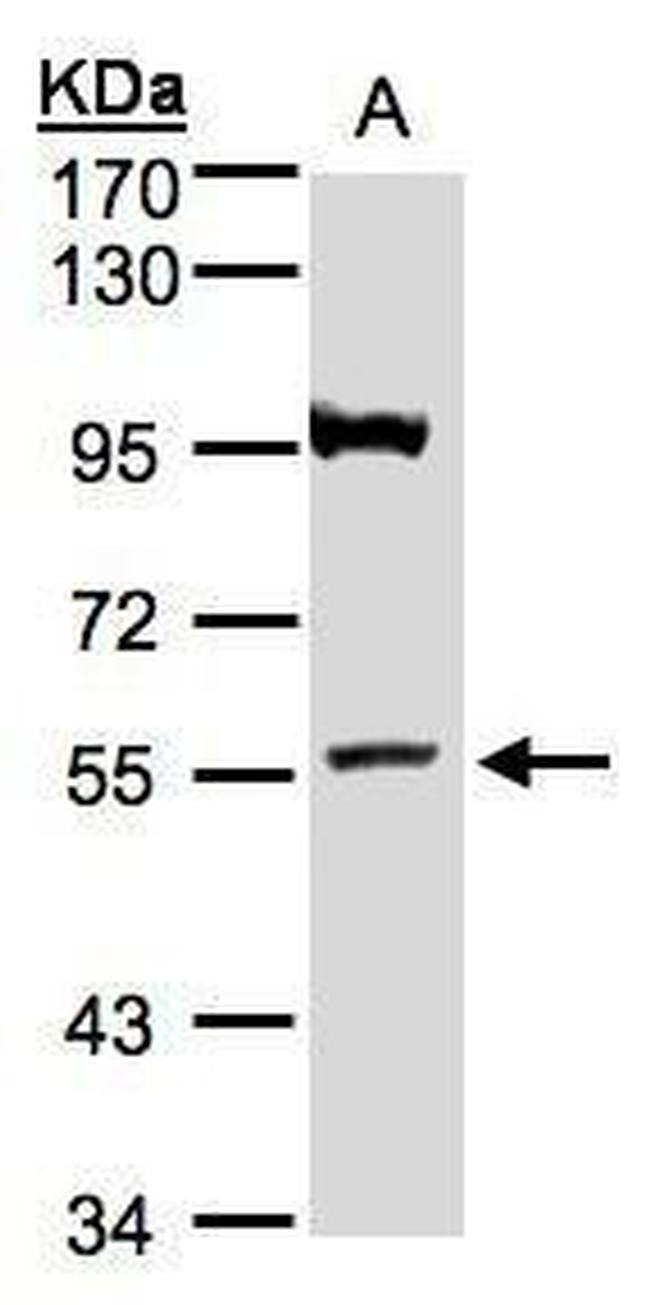 ADAMTSL1 Antibody in Western Blot (WB)