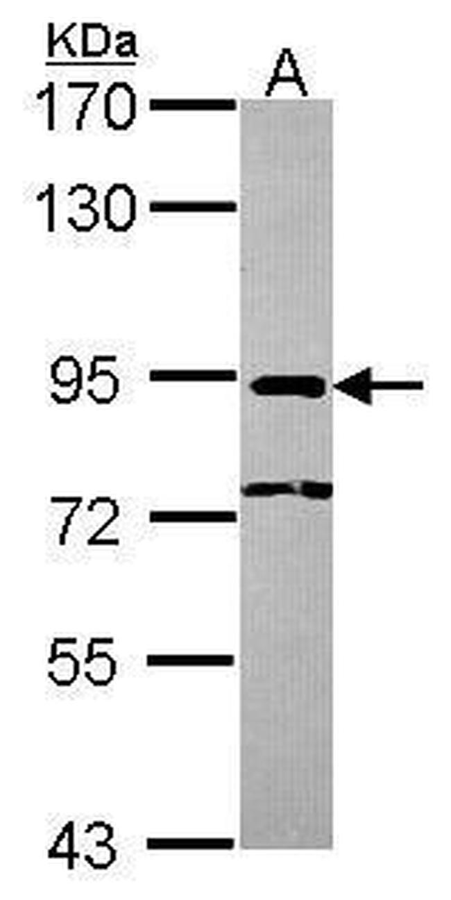 NCBP1 Antibody in Western Blot (WB)