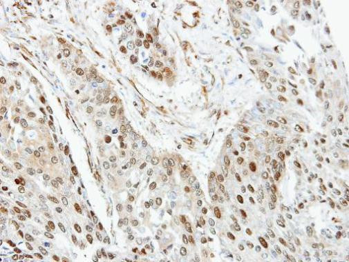 RANGAP1 Antibody in Immunohistochemistry (Paraffin) (IHC (P))