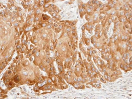 VDP Antibody in Immunohistochemistry (Paraffin) (IHC (P))