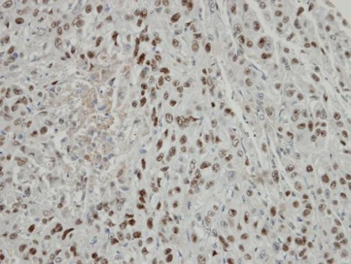 TRIP15 Antibody in Immunohistochemistry (Paraffin) (IHC (P))