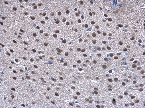 TRIP15 Antibody in Immunohistochemistry (Paraffin) (IHC (P))