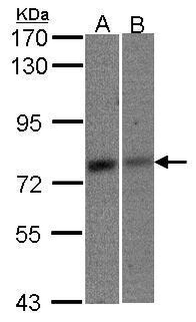 MTA2 Antibody in Western Blot (WB)