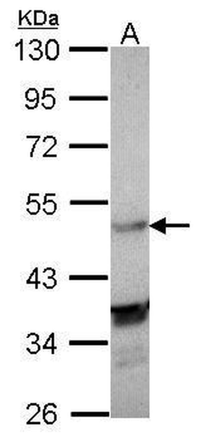 LXR alpha Antibody in Western Blot (WB)