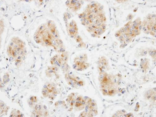 DLC1 Antibody in Immunohistochemistry (Paraffin) (IHC (P))