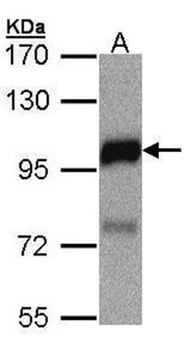 DLC1 Antibody in Western Blot (WB)