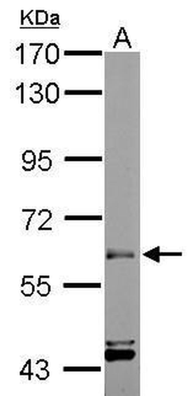 ARIH2 Antibody in Western Blot (WB)