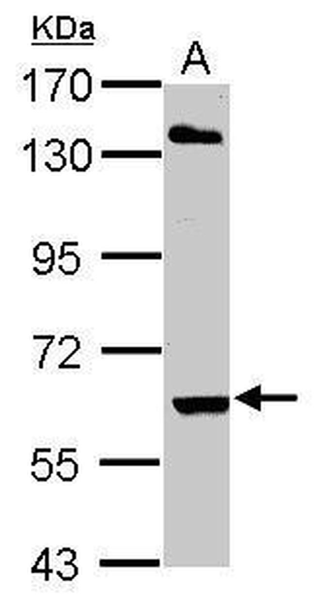 ARIH2 Antibody in Western Blot (WB)