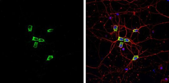 Coronin 1A Antibody in Immunocytochemistry (ICC/IF)