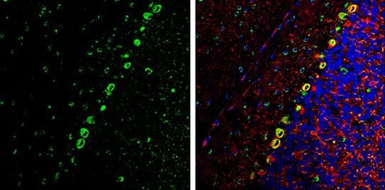 Coronin 1A Antibody in Immunohistochemistry (Frozen) (IHC (F))