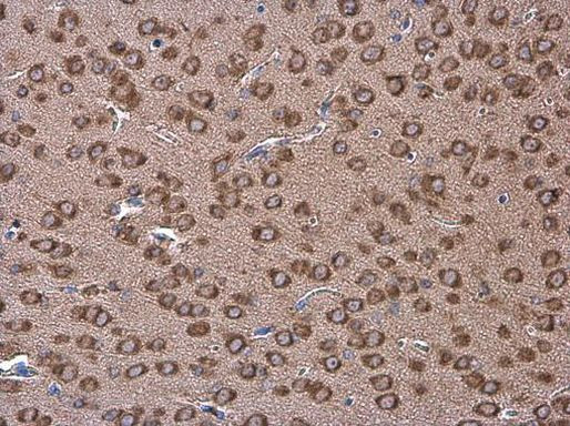 Coronin 1A Antibody in Immunohistochemistry (Paraffin) (IHC (P))