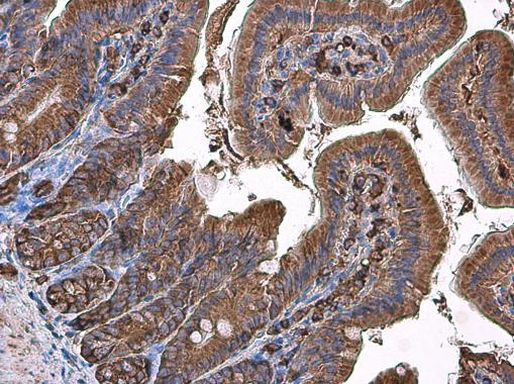 Coronin 1A Antibody in Immunohistochemistry (Paraffin) (IHC (P))