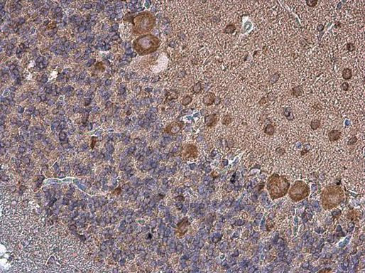 Coronin 1A Antibody in Immunohistochemistry (Paraffin) (IHC (P))